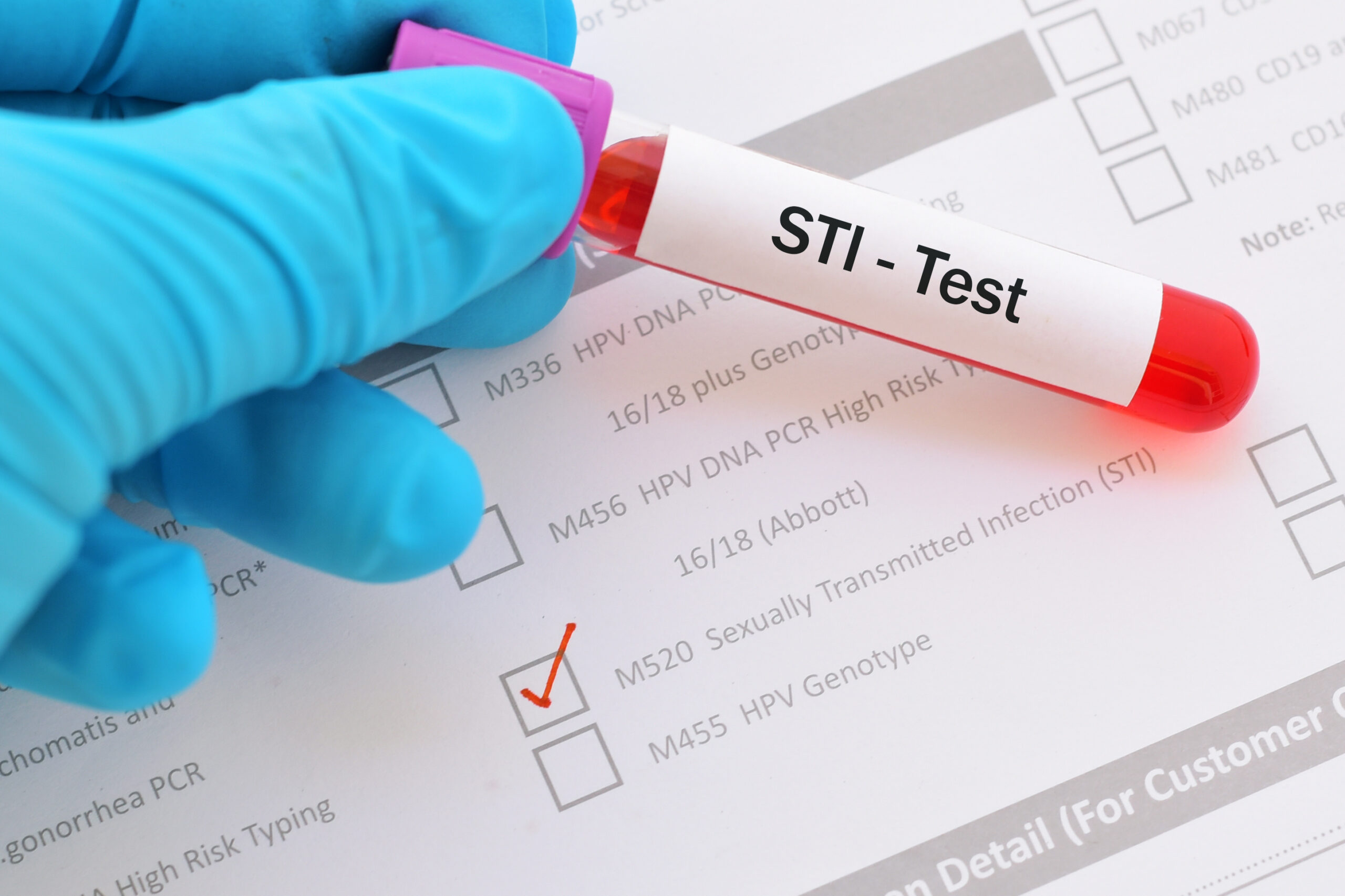 sexually transmitted infection